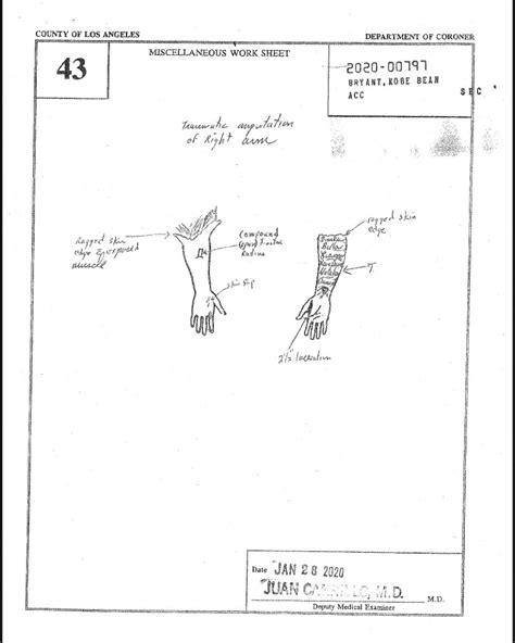 gigis autopsy report|Gianna and Kobe Bryants Autopsy Report Finally。